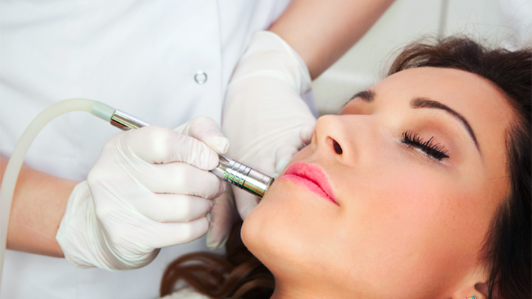 Microneedling