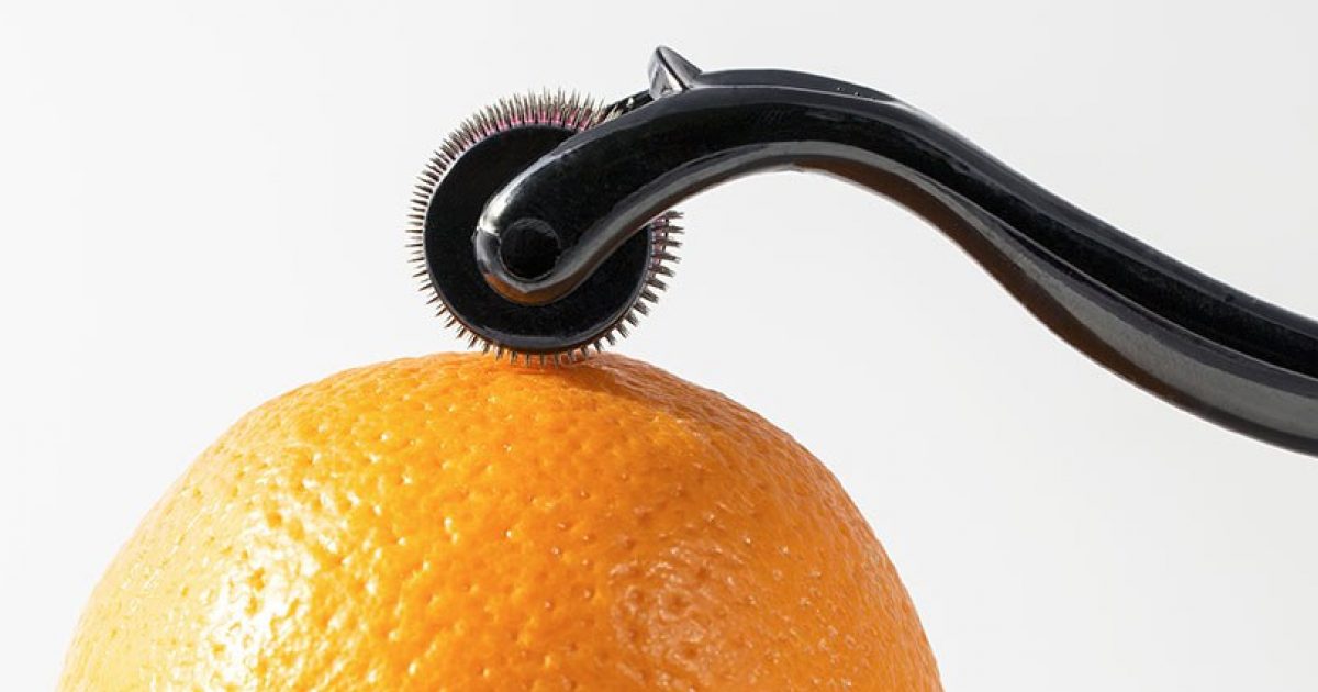 SI_MicroneedlingTools_425