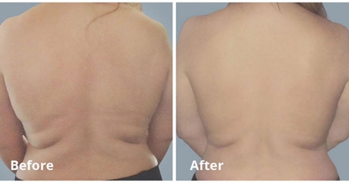 bodyfx-ba1