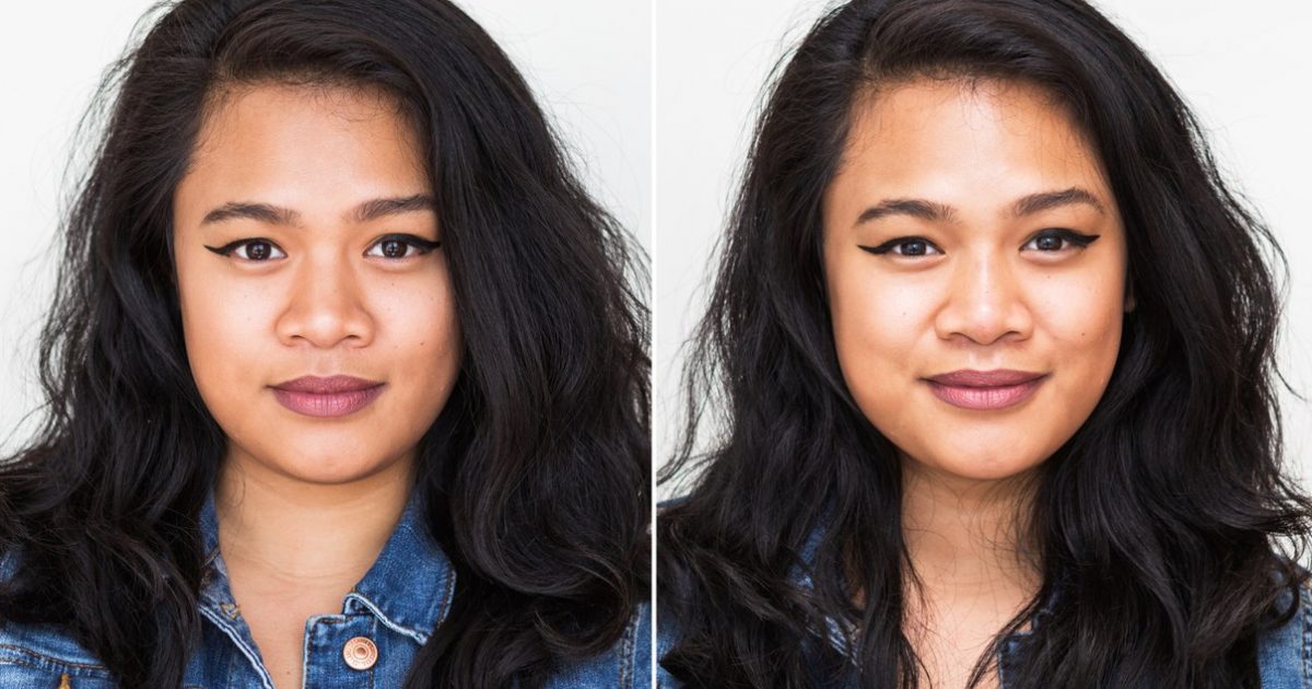jesa-nose-job-before-after