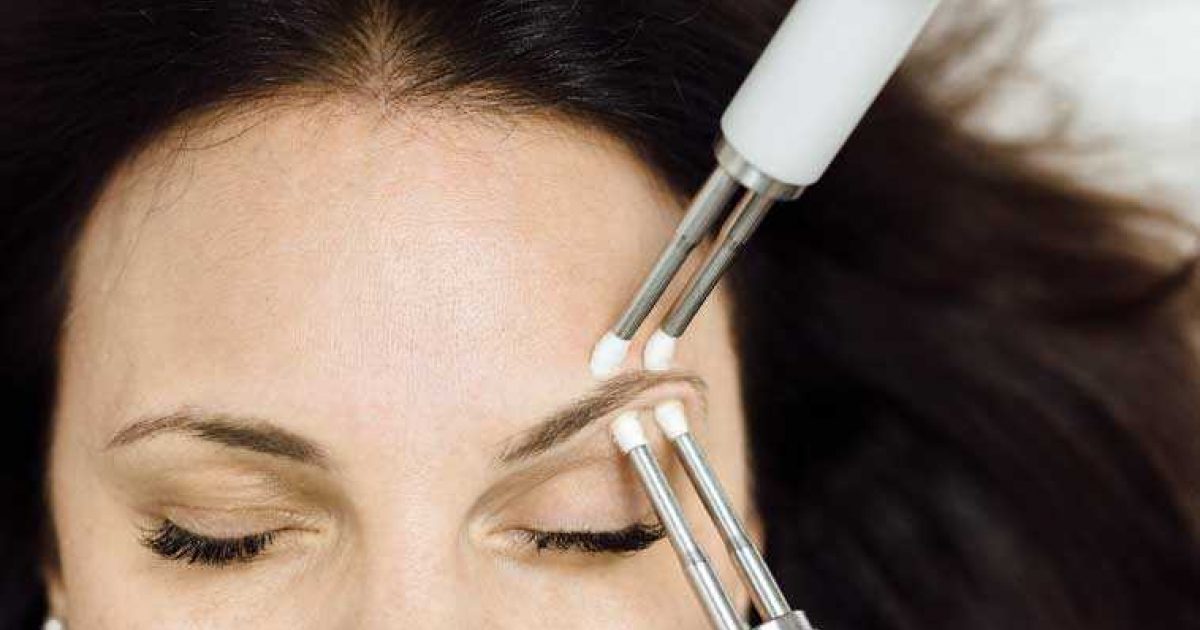 microcurrent-vs-botox-2